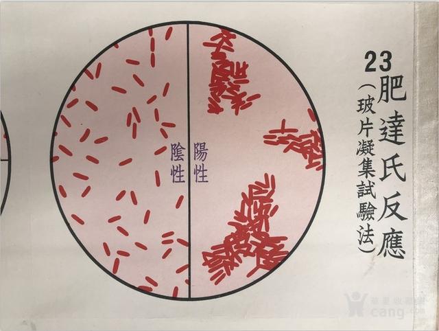 秋季肠道感染性疾病的预防