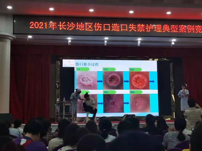 市第九老王论坛
在市伤口造口失禁护理典型案例竞赛中荣获一等奖